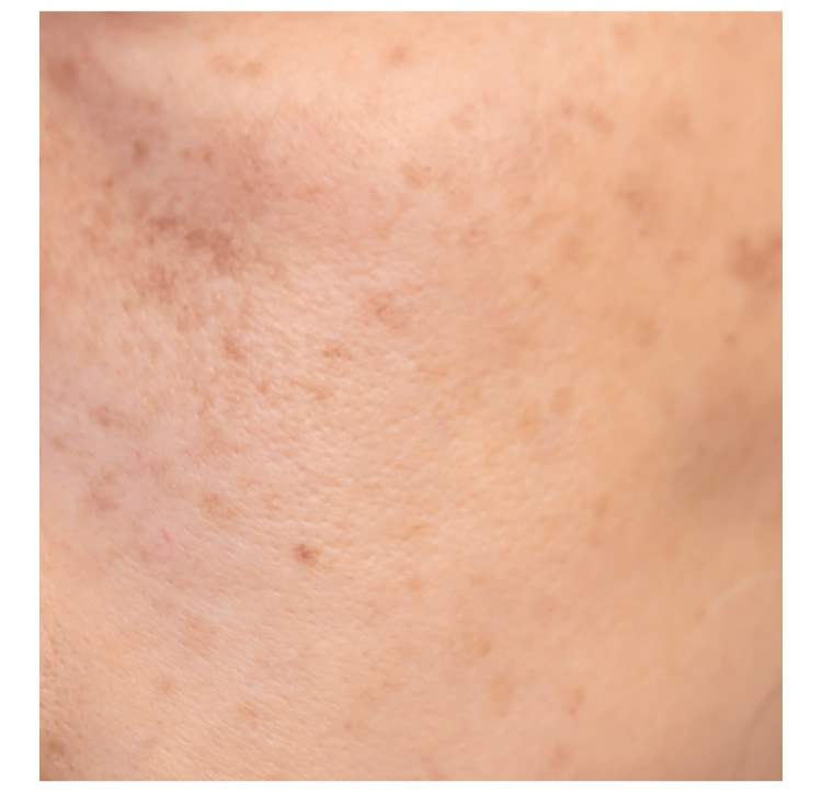 肌のバリア機能