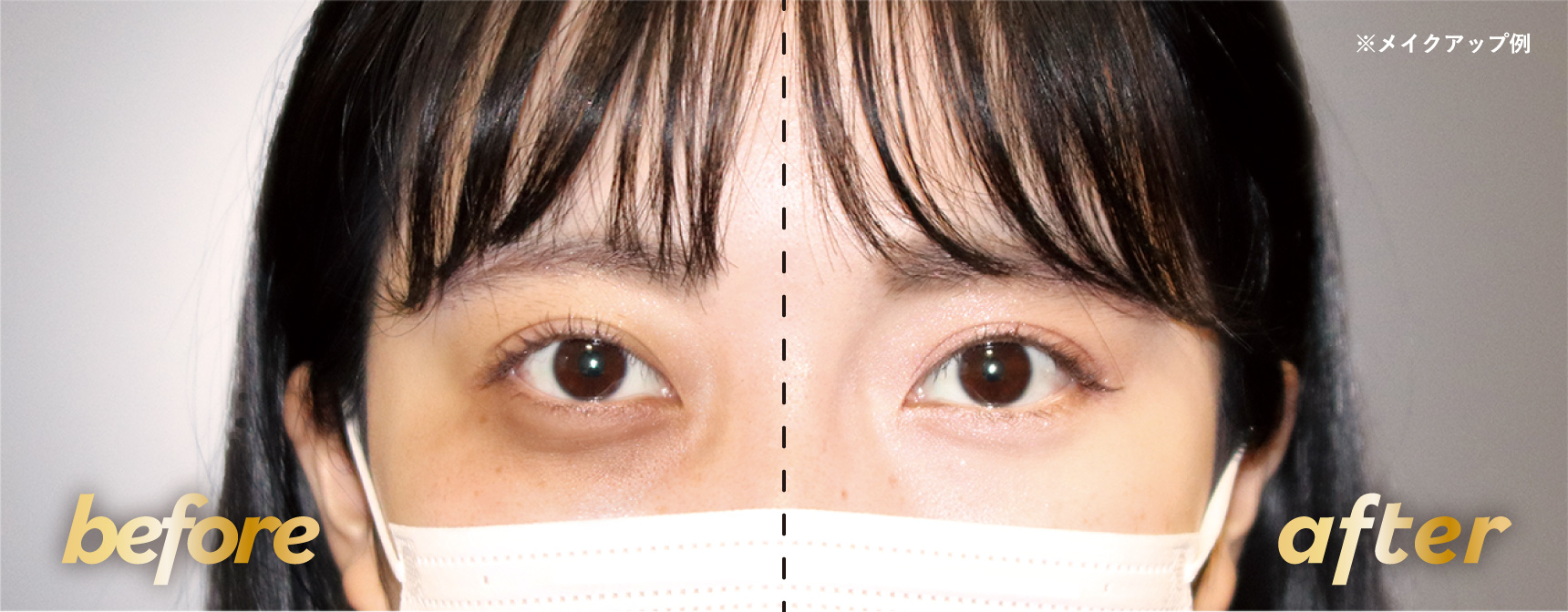 Before / After