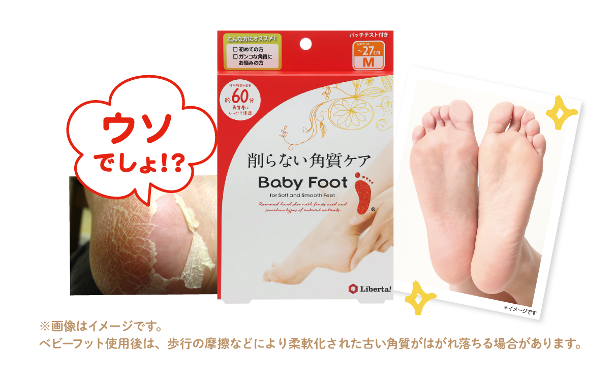 ※画像はイメージです。ベビーフット使用後は、歩行の摩擦などにより柔軟化された古い角質がはがれ落ちる場合があります。
