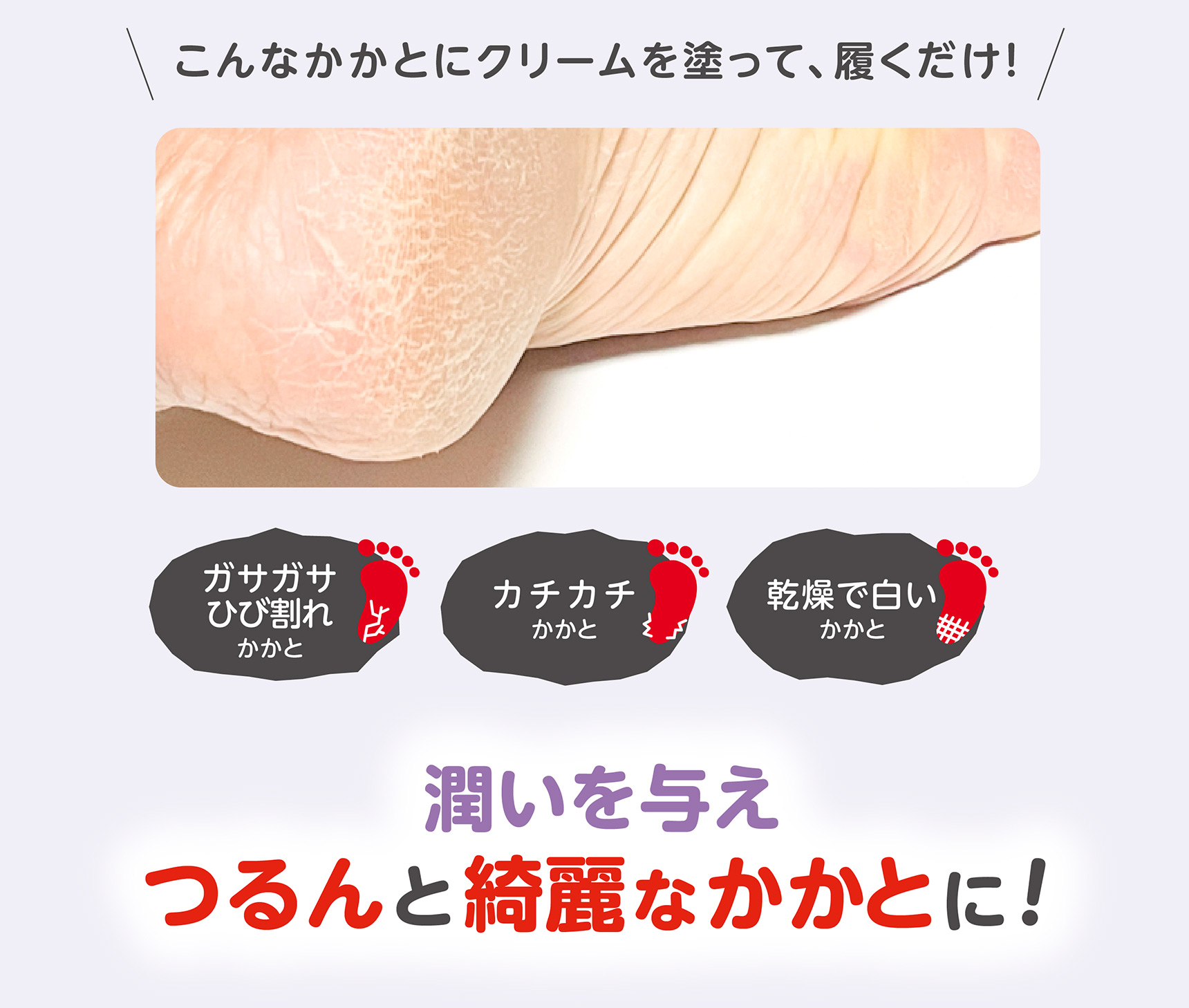こんなかかとにクリームを塗って、履くだけ！ ガサガサひび割れかかと / カチカチかかと / 乾燥で白いかかと 潤いを与え、つるんと綺麗なかかとに！