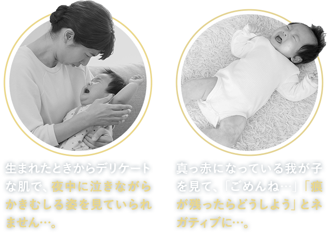 【夜中に泣きながらかきむしる姿を見ていられません…。】【「痕が残ったらどうしよう」とネガティブに…。
