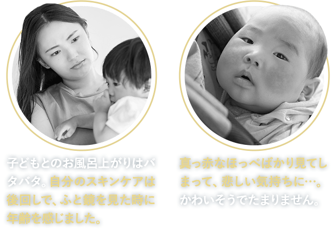 【自分のスキンケアは後回しで、ふと鏡を見た時に年齢を感じました。】【真っ赤なほっぺばかり見てしまって、悲しい気持ちに…。】