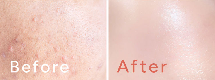 Before After