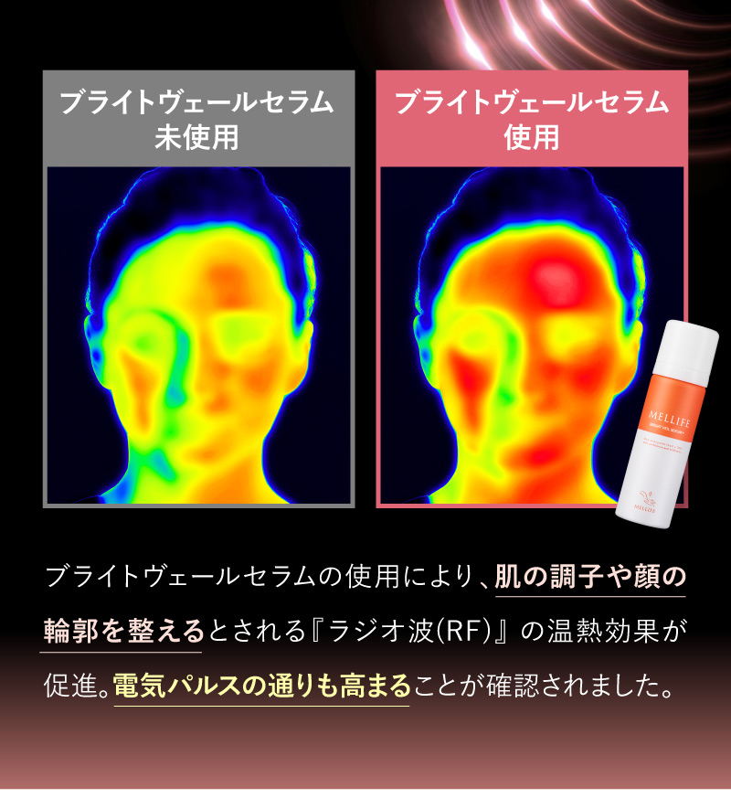 ブライトヴェールセラムの使用により、肌の調子や顔の輪郭を整えるとされる『ラジオ波(RF)』 の温熱効果が促進。電気パルスの通りも高まることが確認されました。