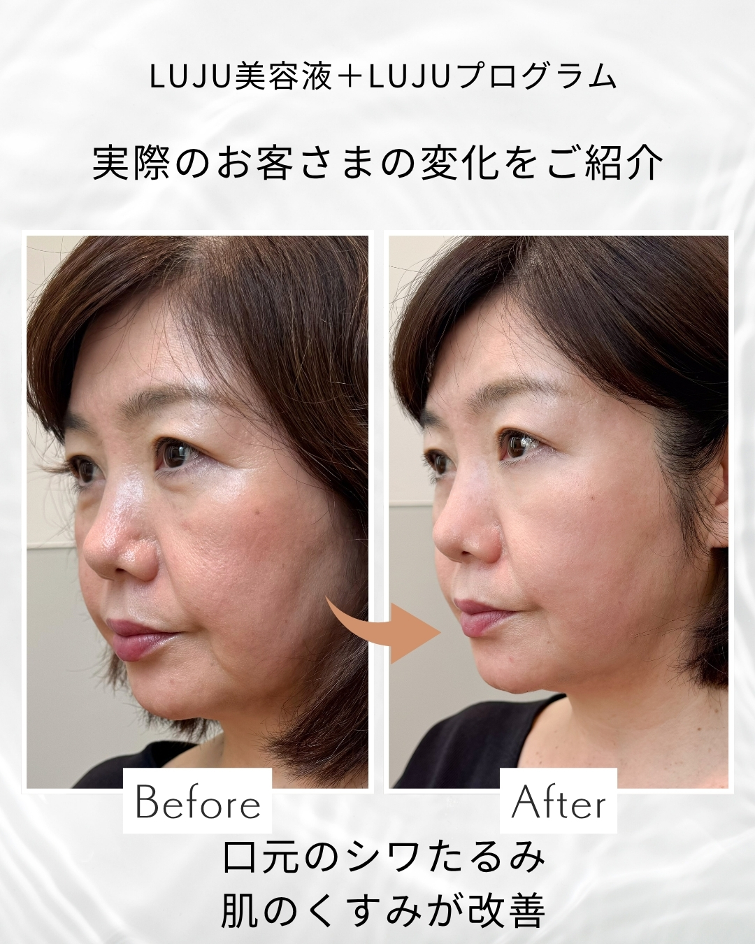 LUJU start time serum　単品