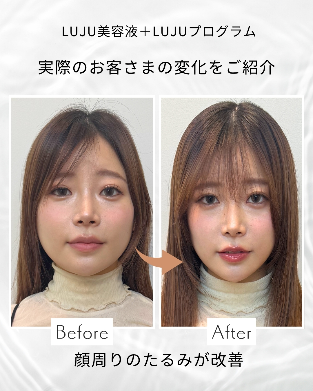 LUJU start time serum　単品