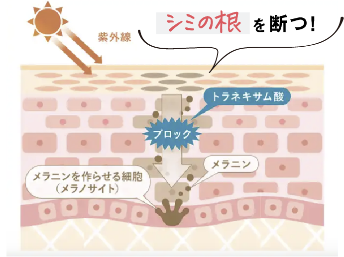 ナイアシンアミドがシミの根を断つ!