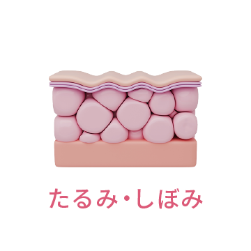 たるみ・しぼみ