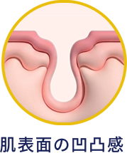 肌表面の凸凹感