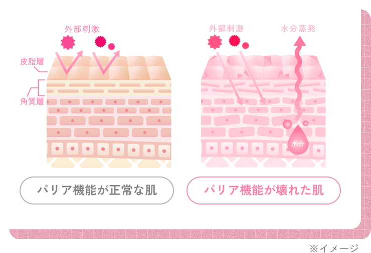 肌がゆらぐわけ イメージ