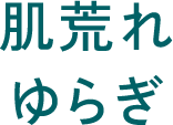 肌荒れ ゆらぎ
