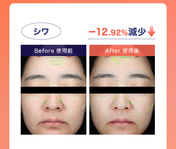 シワ −12.92％減少