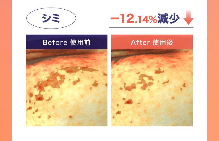 シミ −12.14％減少