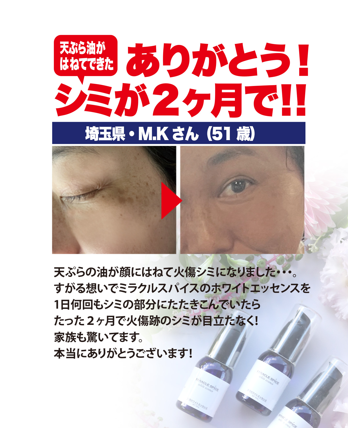 薬用ホワイトエッセンス　30ｍL 個数: 1個