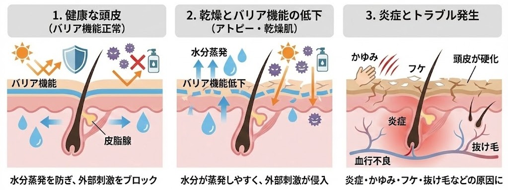 バリア機能の低下