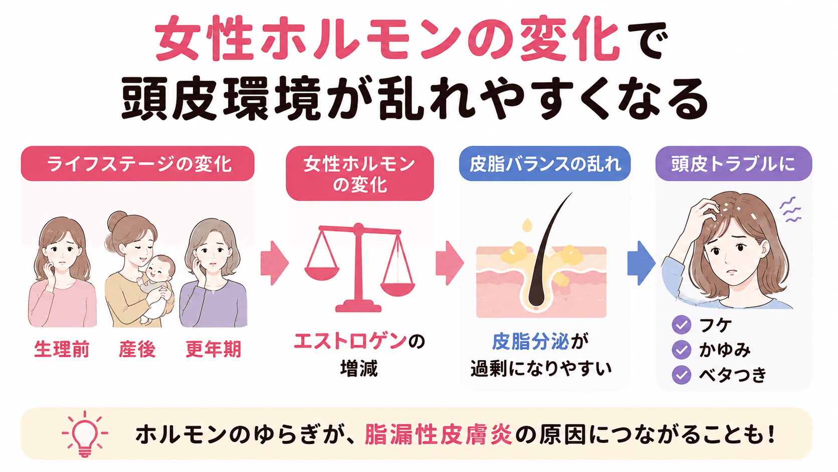 脂漏性皮膚炎と女性ホルモンの図解画像