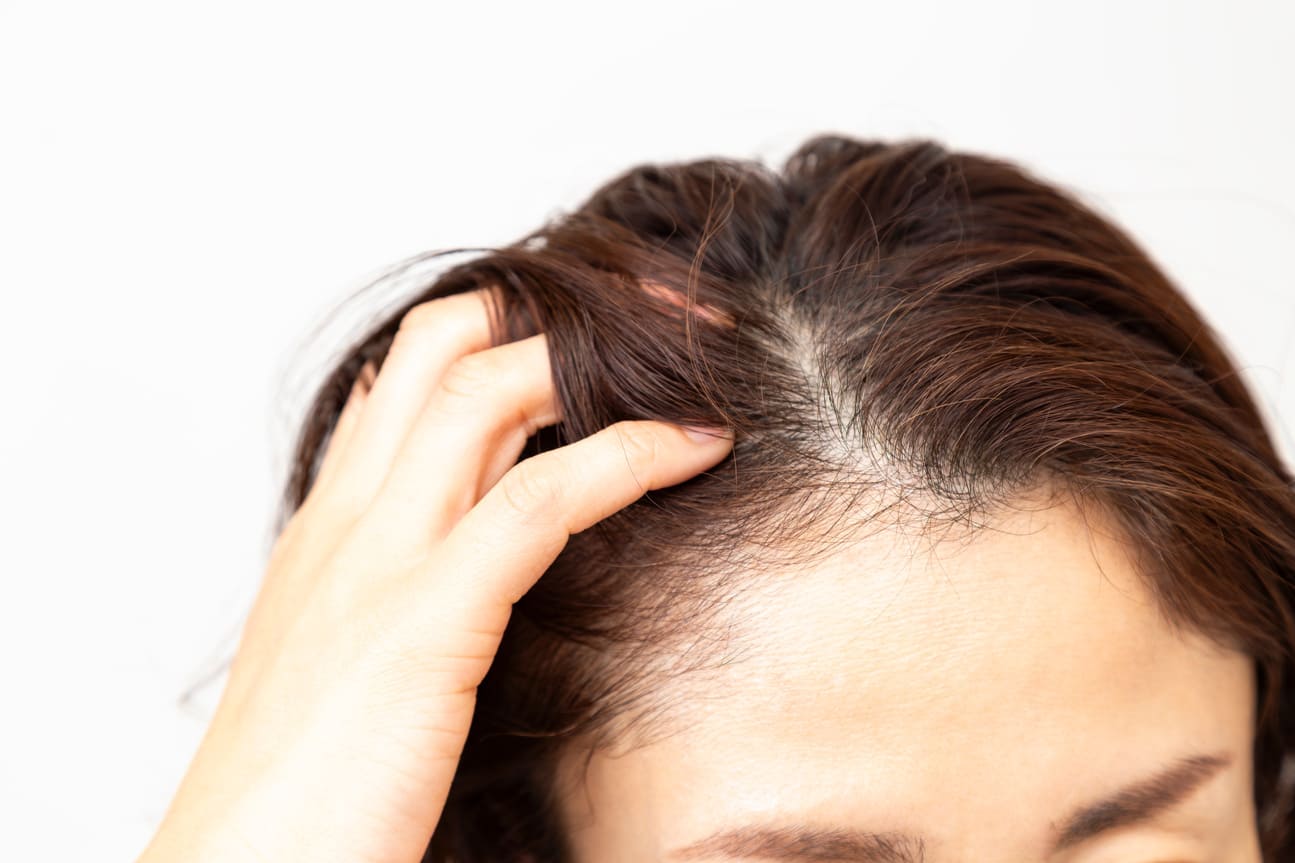 頭皮に悩んでる人