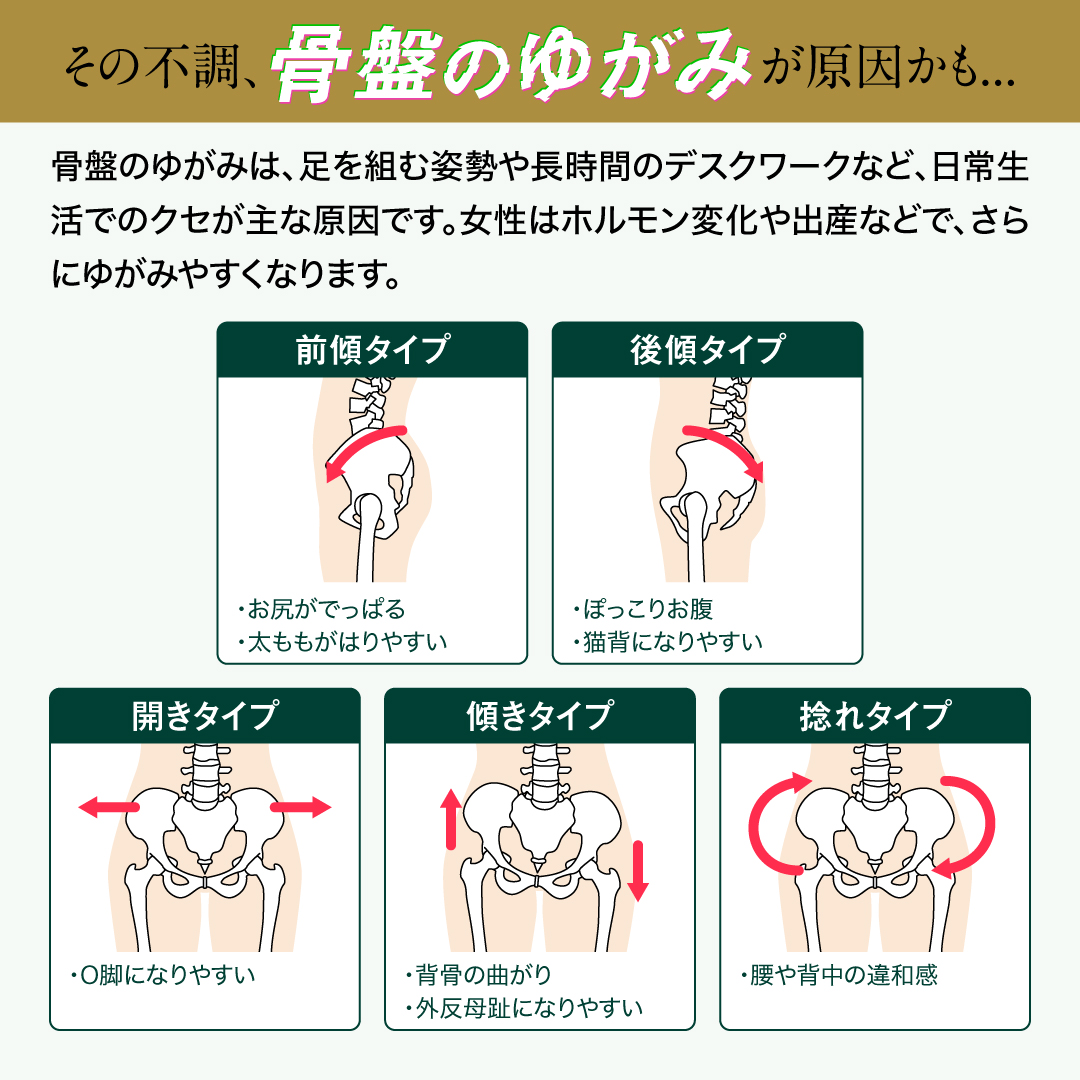 異次元ホールド骨盤サポーター サイズ: M (骨盤周り78〜92cm)