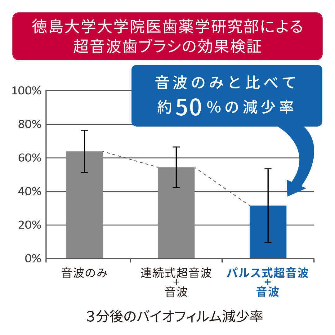 パルス式超音波歯ブラシ reclean 24/7（リクリーン トゥエンティーフォーセブン） カラー: レッド
