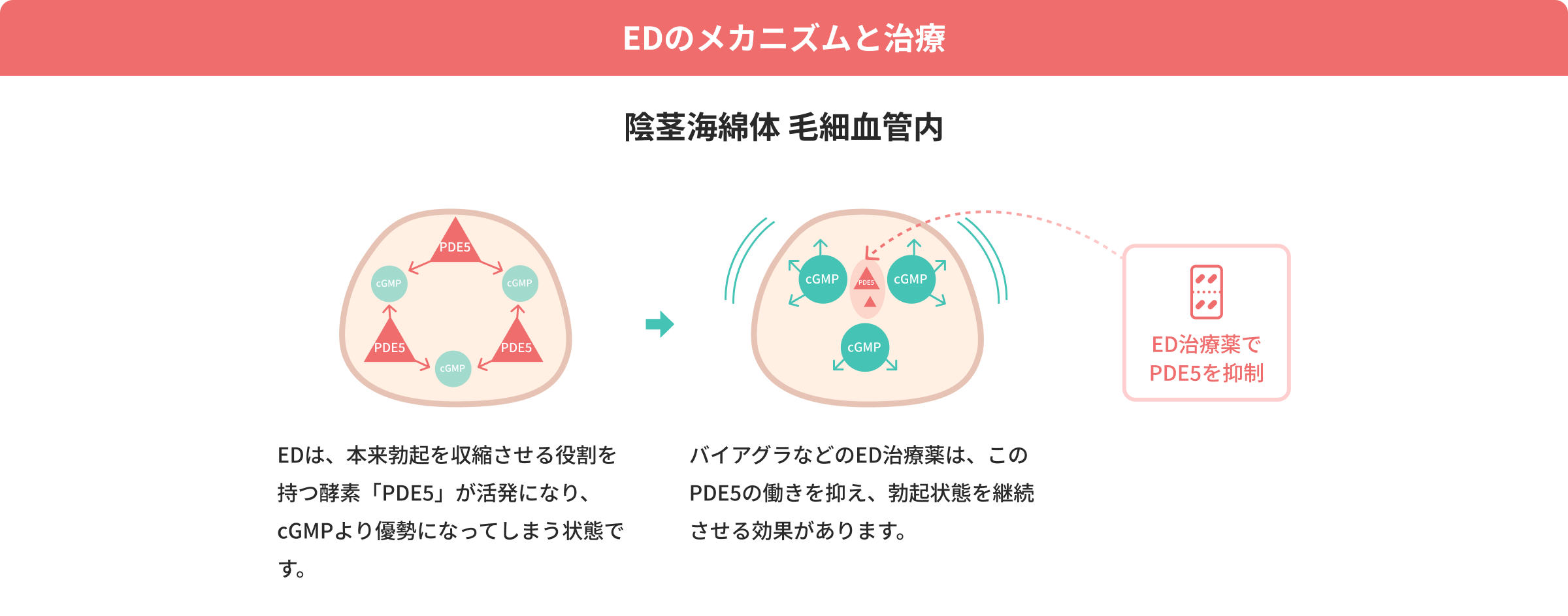 EDのメカニズムと治療