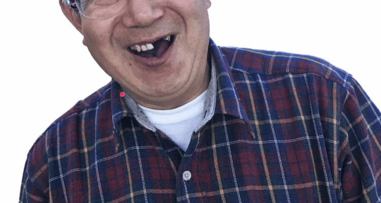 歯が抜けている画像