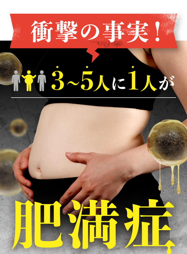 3〜5人に1人が肥満症