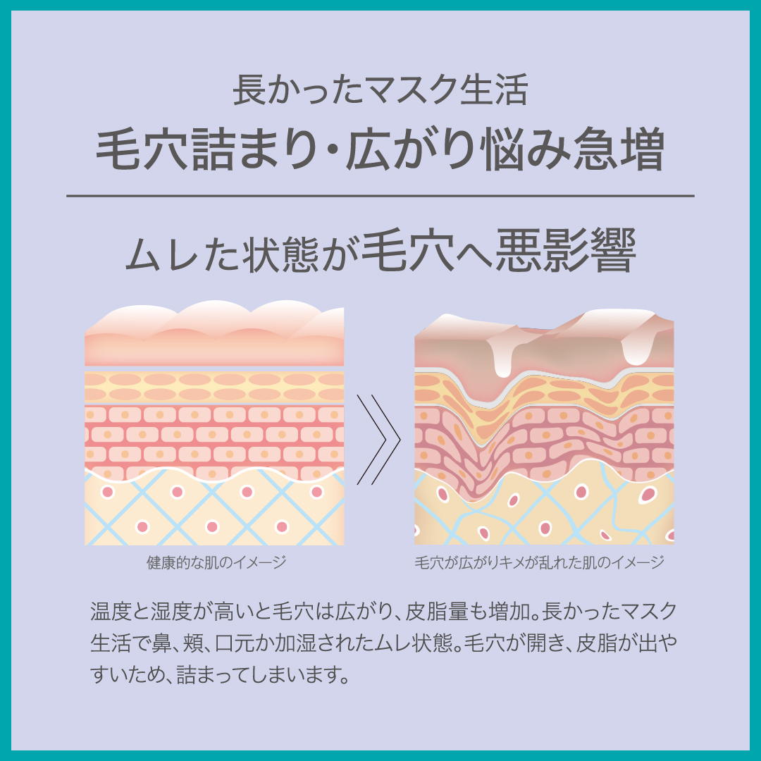 【　送料無料　】　GGシリーズ　薬用GGバランシングローション