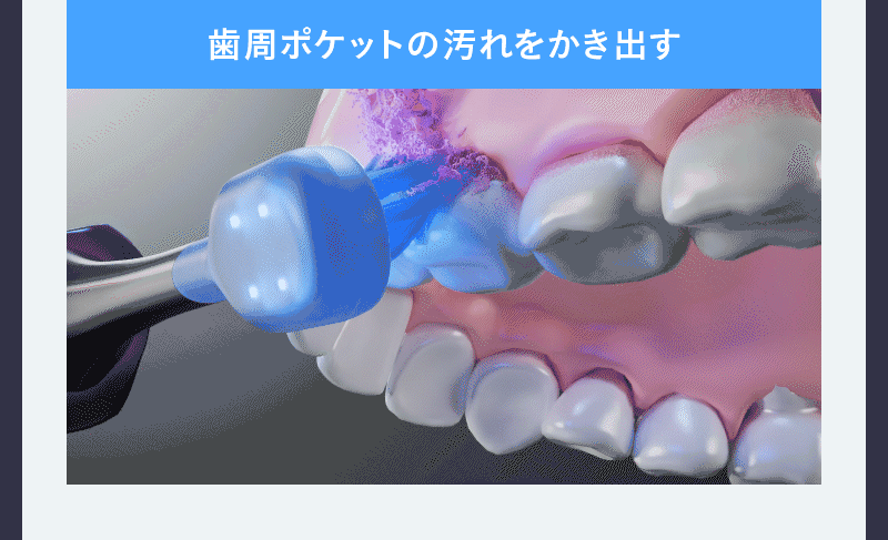 次世代電動歯ブラシ