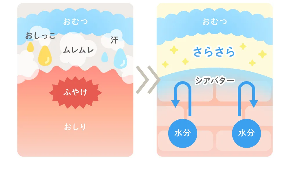 よだれや食べこぼしで荒れやすいくちびるをケア