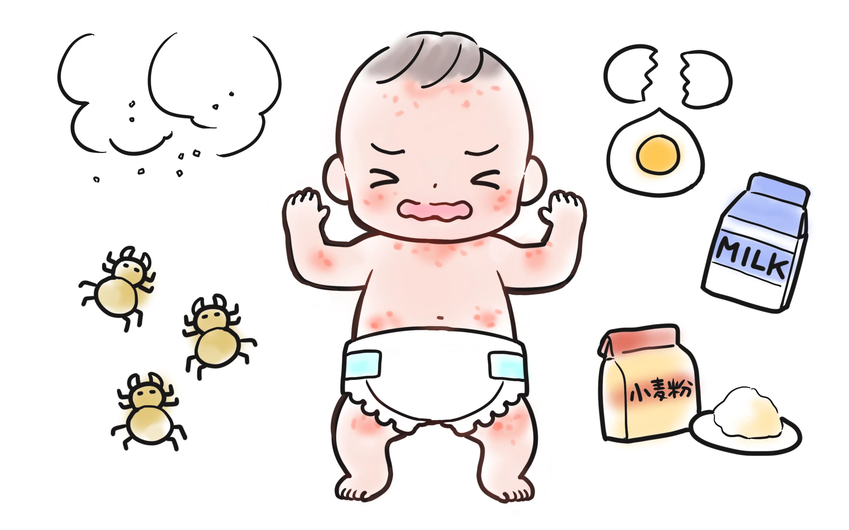 知っておきたい赤ちゃんのアレルギー症状とは？予防と対処