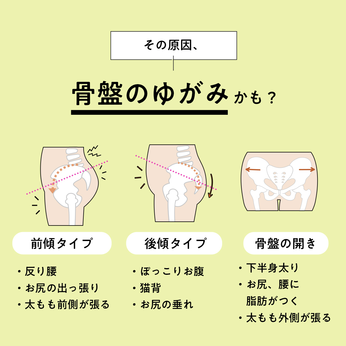 フラミンゴレギンス サイズ: M-L