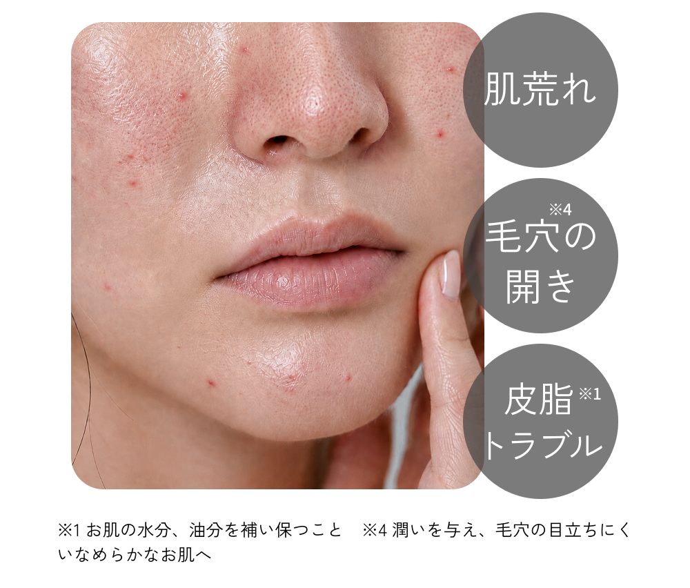 肌荒れ・毛穴の開き※4・皮脂トラブル※1に悩む女性の肌の接写
