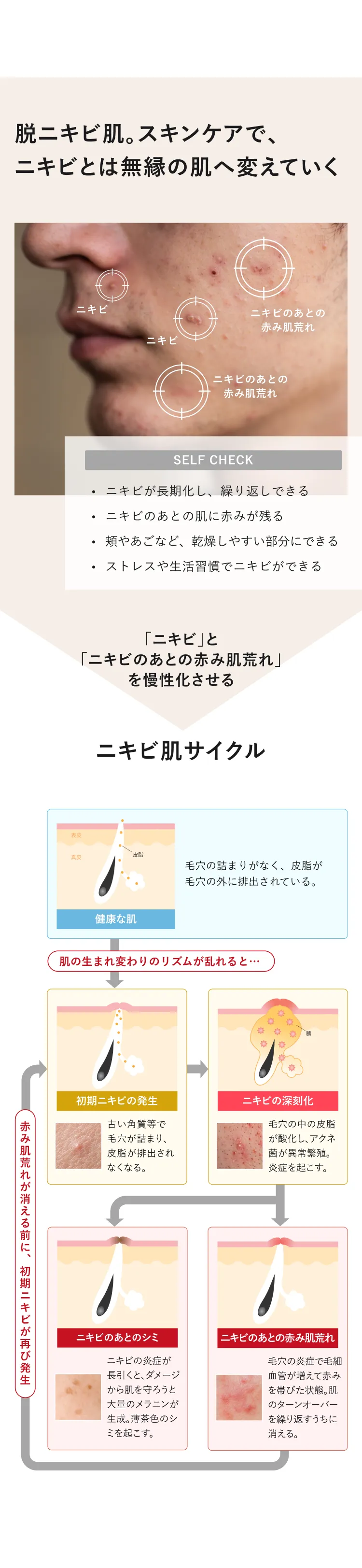 ボタニカル アクネ ＆ ポア トリートメント（メンズ 薬用ニキビ ケア