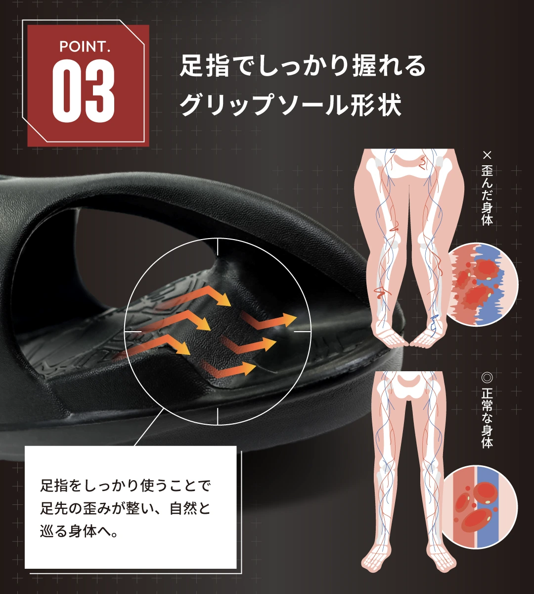 ストレッチアンカー