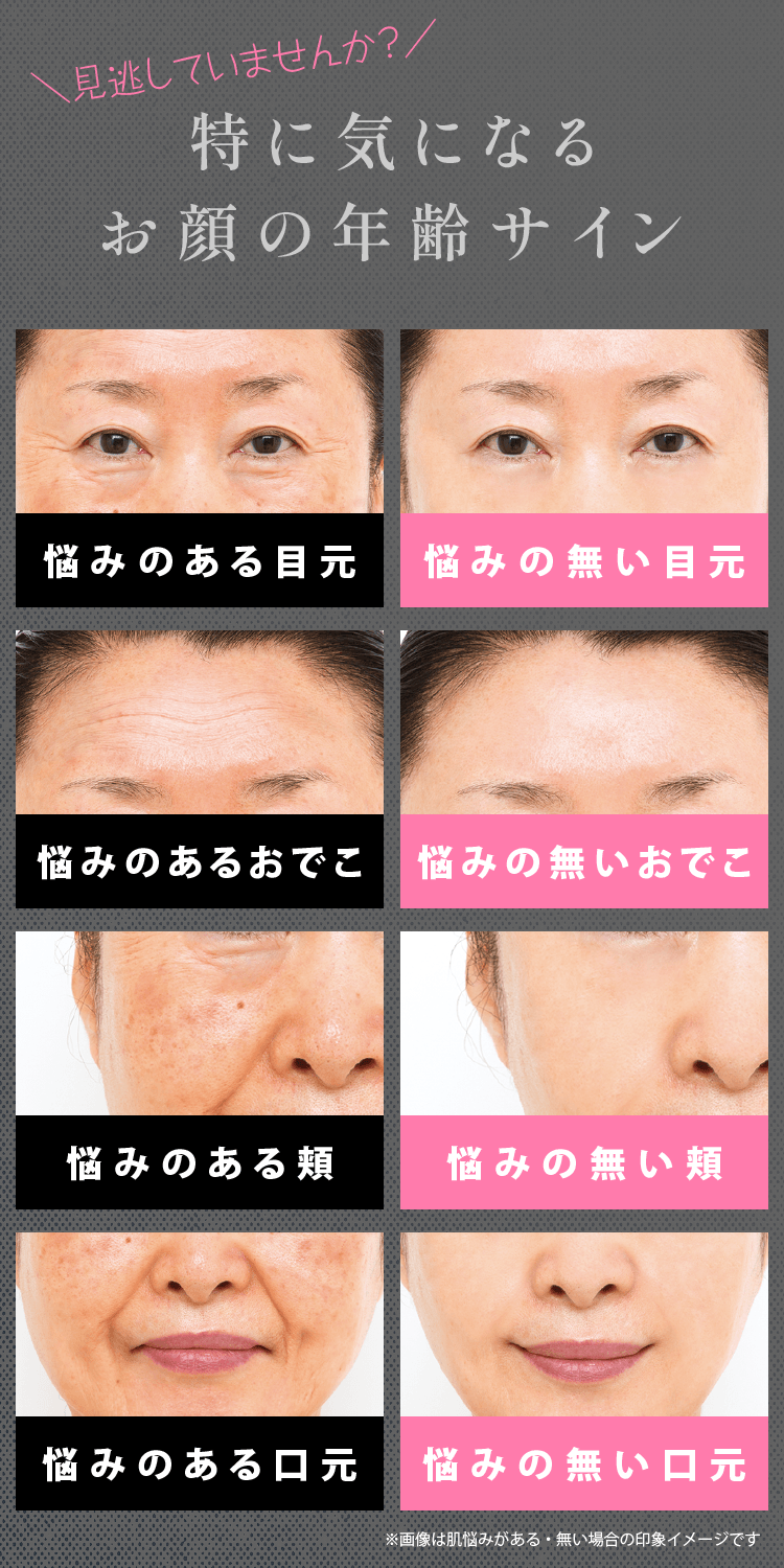 特に気になるお顔の年齢サイン