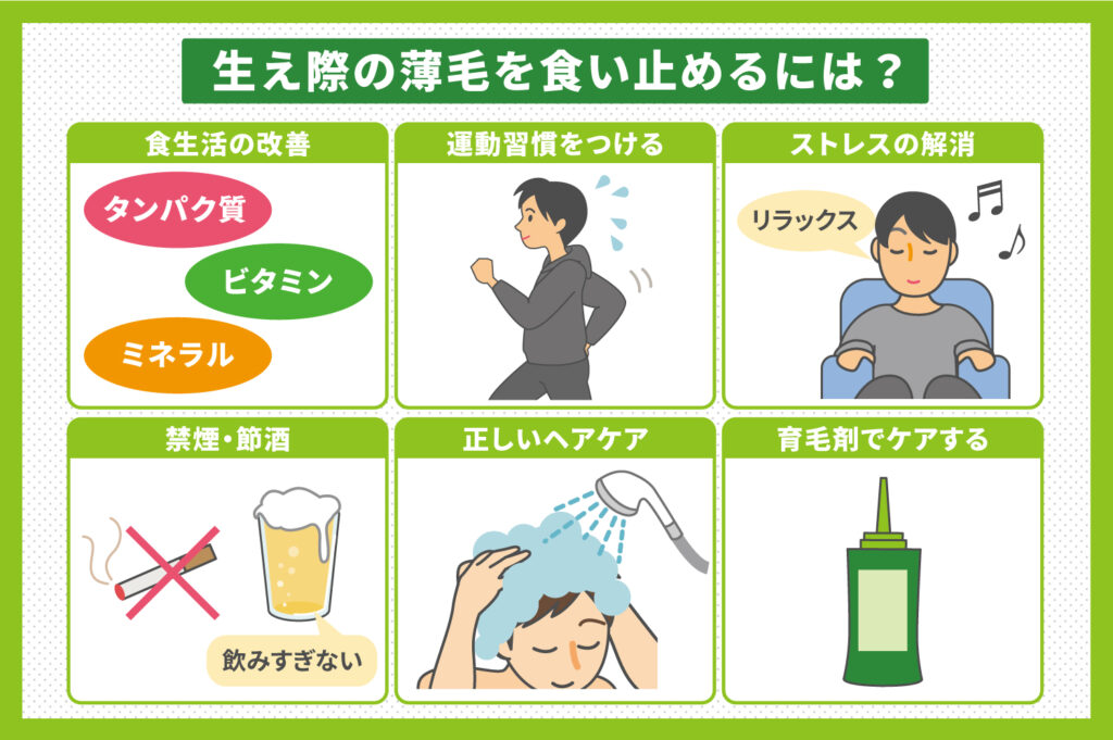 生え際の薄毛を食い止めるには？