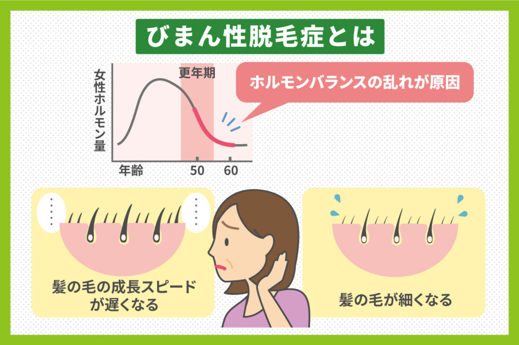 びまん性脱毛症とは