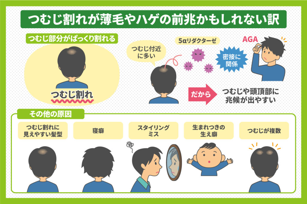 つむじ割れは将来薄毛やハゲになる兆候？