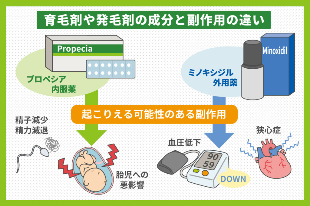 発毛剤で起こりえる可能性のある副作用