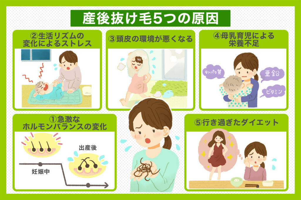 産後抜け毛 ５つの原因