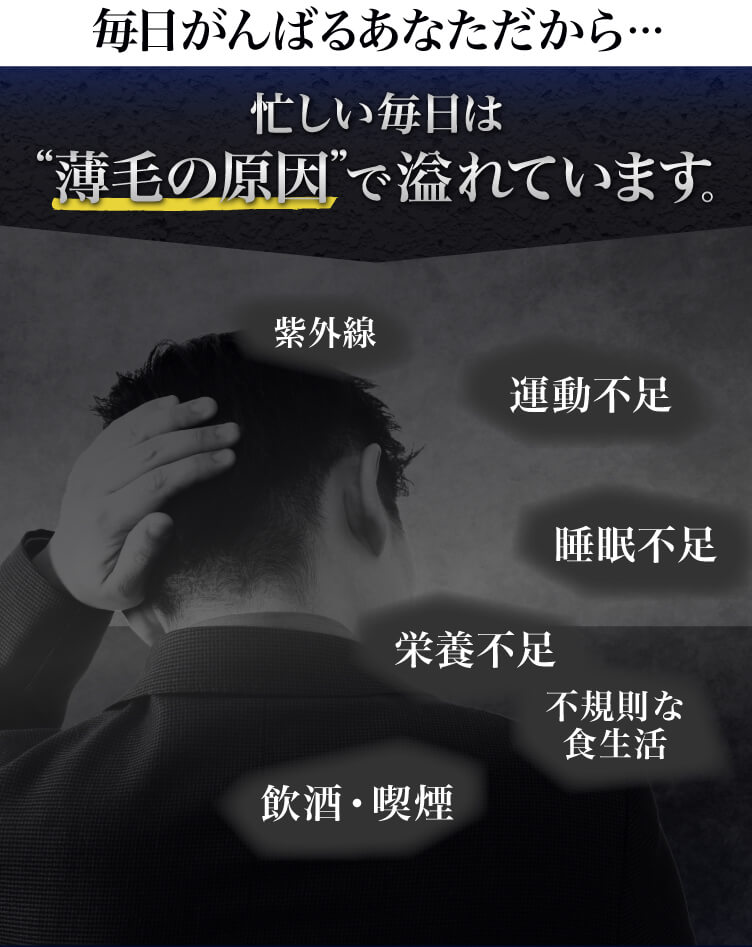 忙しい毎日は薄毛の原因で溢れています