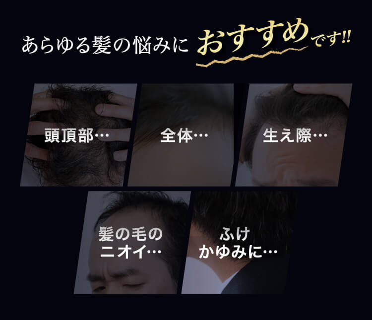 あらゆる髪の悩みにおすすめです