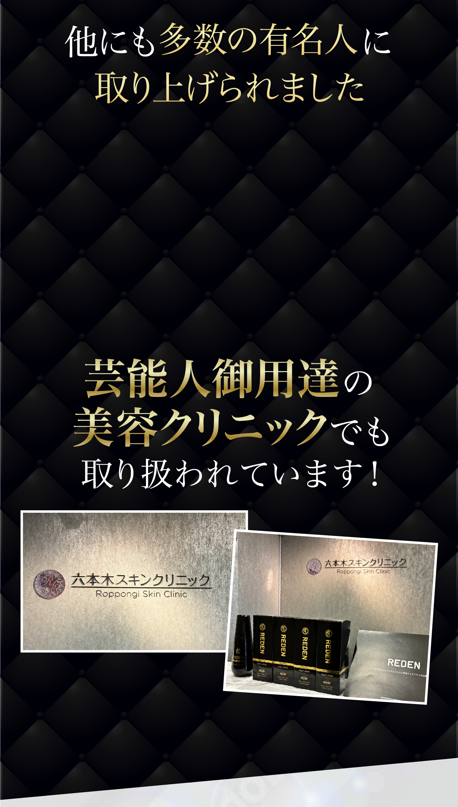 今、薬用育毛剤REDENが様々なところで話題に！