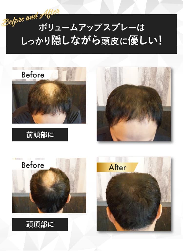 ボリュームアップスプレーはしっかり隠しながら頭皮に優しい！