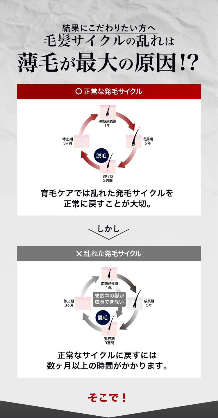 毛髪サイクルの乱れは薄毛が最大の原因!?