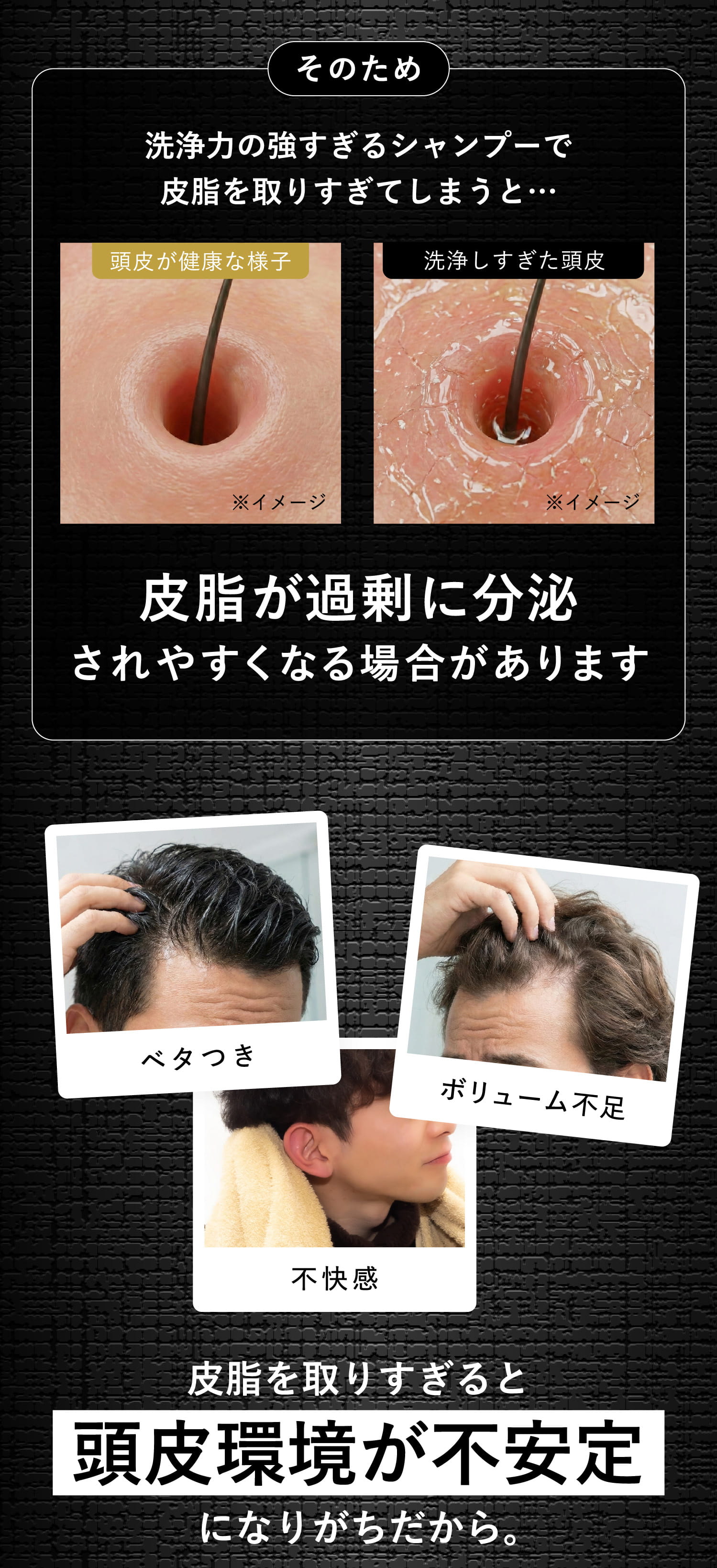 洗浄力の強すぎるシャンプーで皮脂を取りすぎてしまうと・・・皮脂が過剰に分泌されやすくなる場合があります