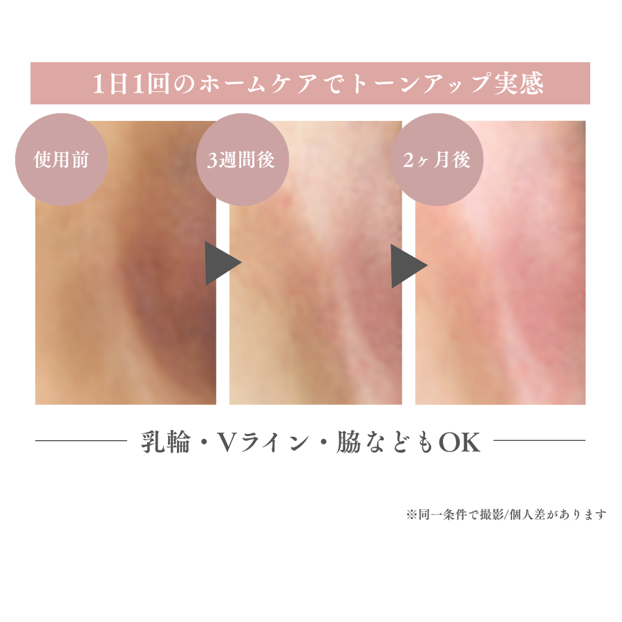 エステサロン月商150万円