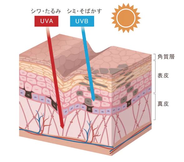 紫外線