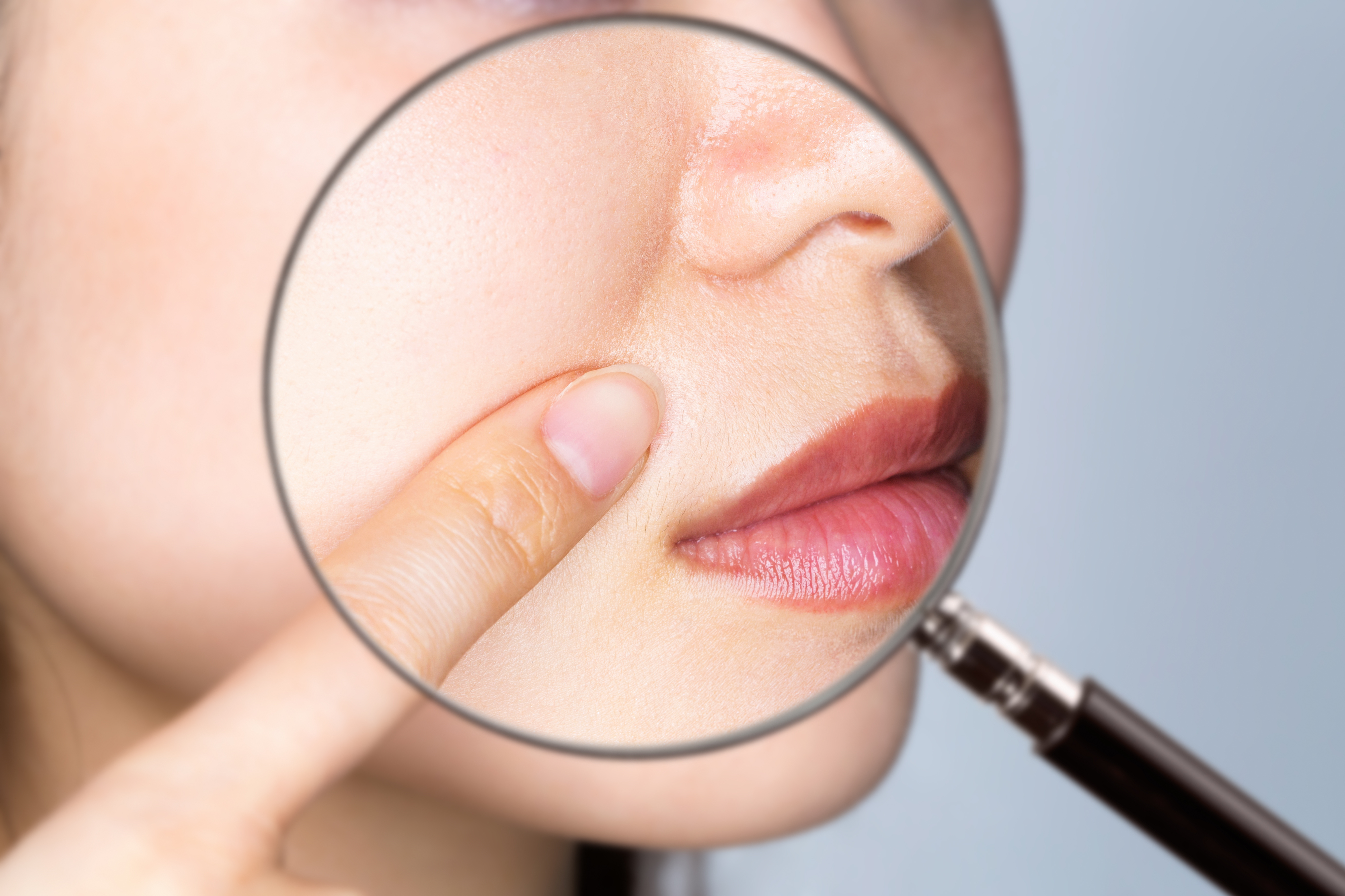 若いのにほうれい線が目立つのはなぜ？原因と対処法