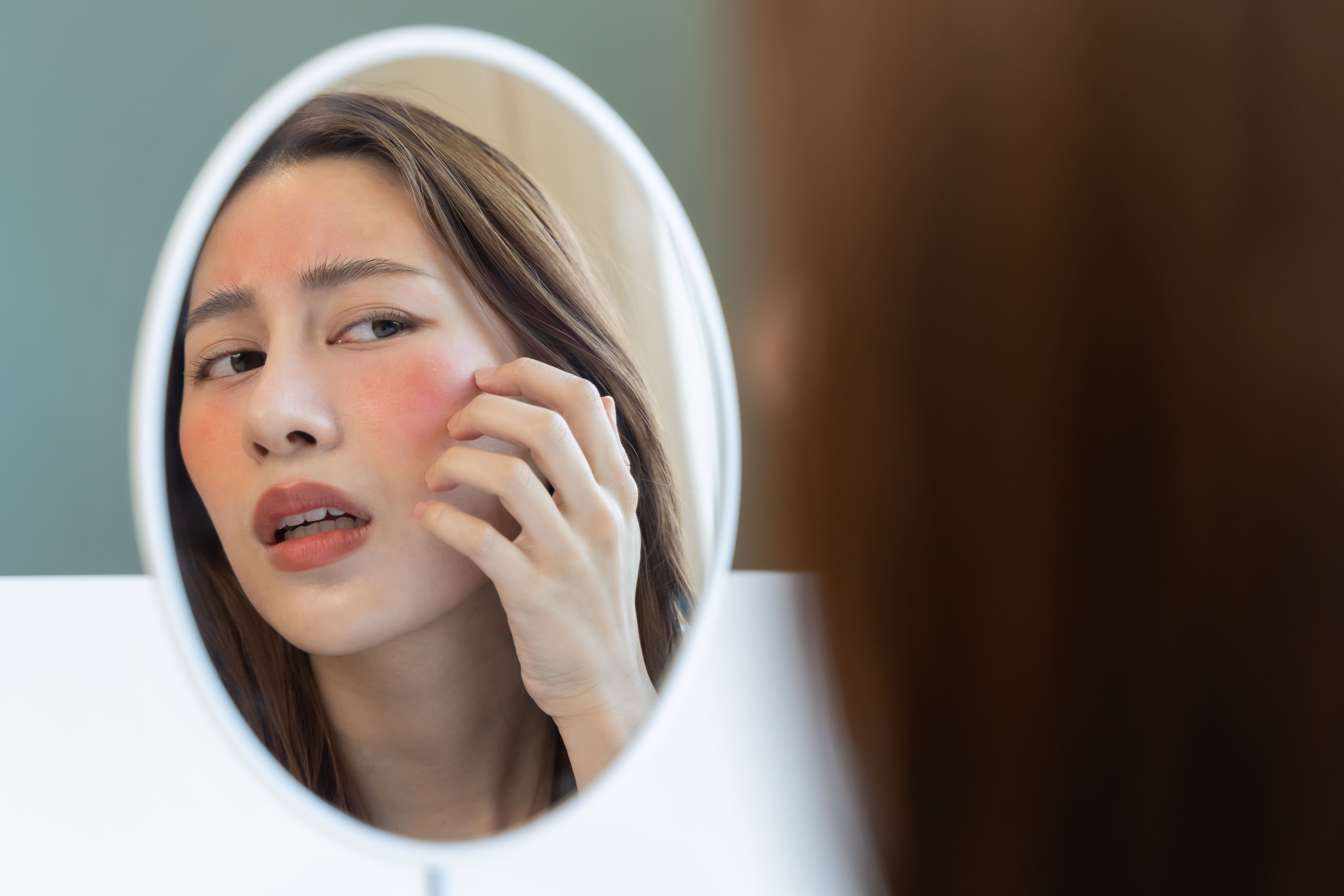 赤ら顔の原因はバリア機能の低下？敏感肌でも使えるおすすめ化粧品